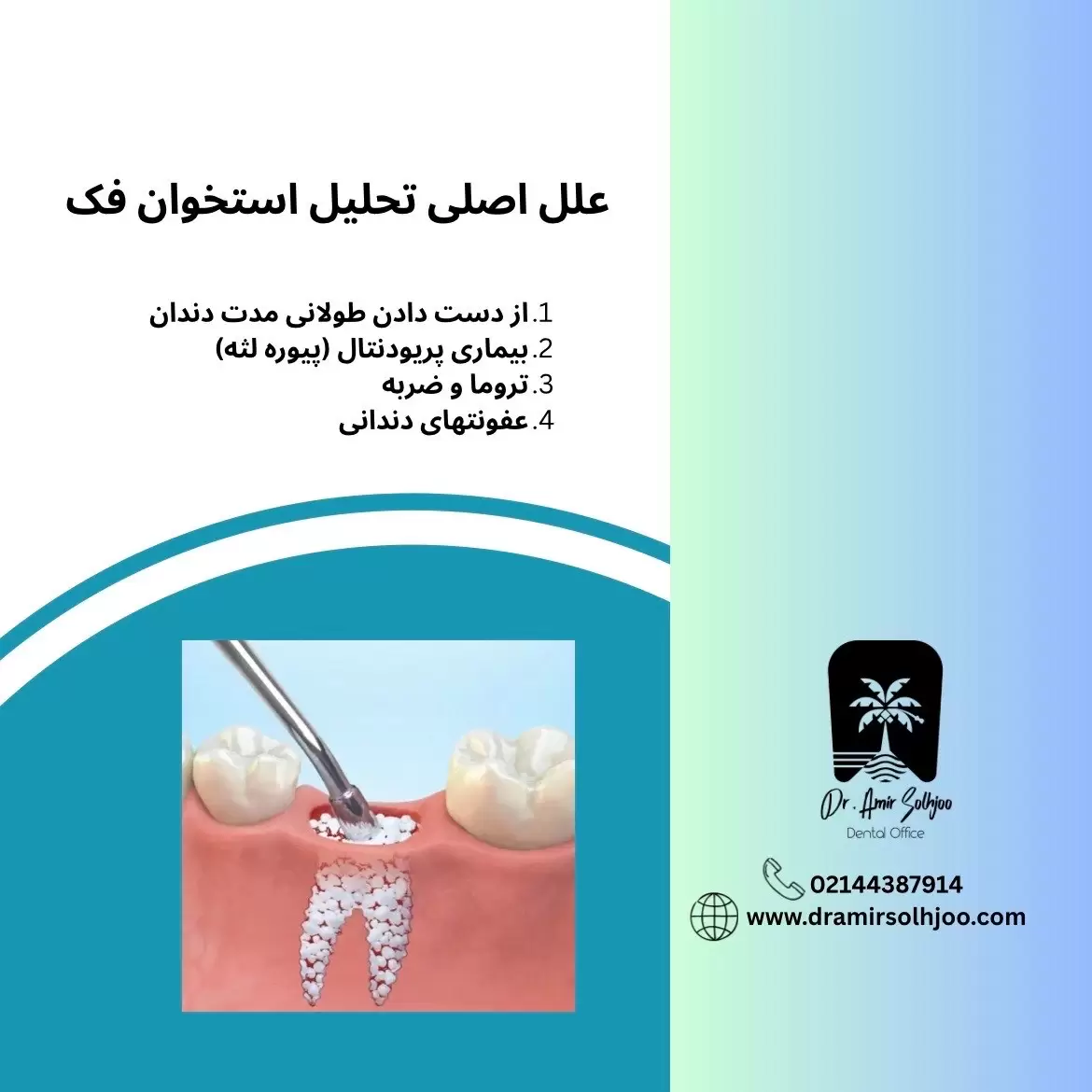 جی بی ار در ایمپلنت