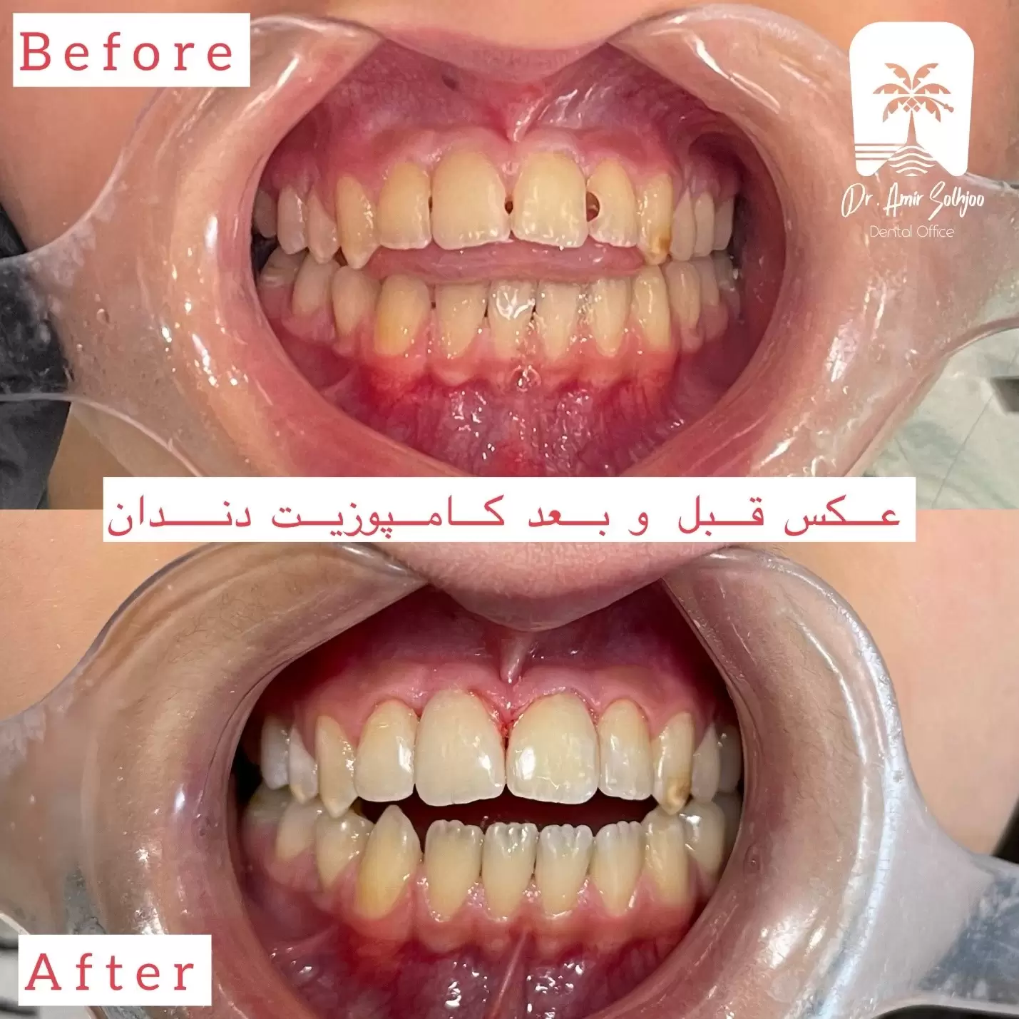 دندانپزشک زیبایی در شهرک غرب