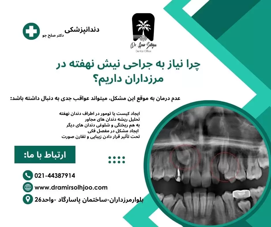 جراحی نیش نهفته در مرزداران