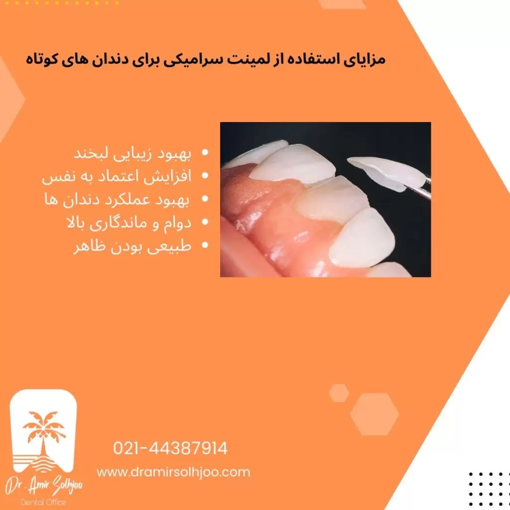 لمینت سرامیکی برای دندان های کوتاه