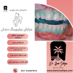 قیمت بلیچینگ دندان ۱۴۰۴