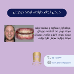 طراحی لبخند دیجیتال