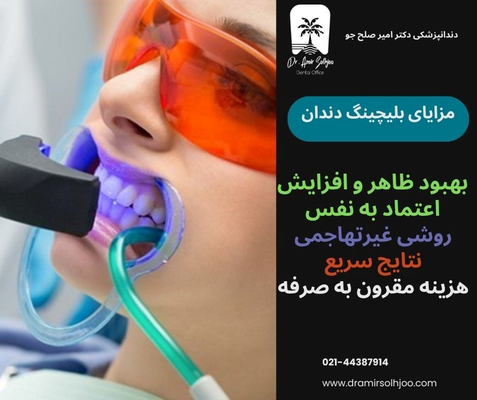 قیمت بلیچینگ دندان در ایران