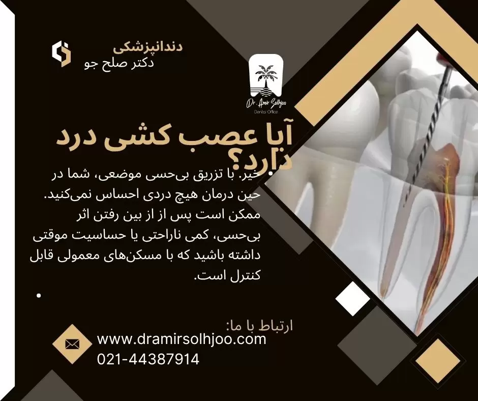 عصب کشی درد دارد؟