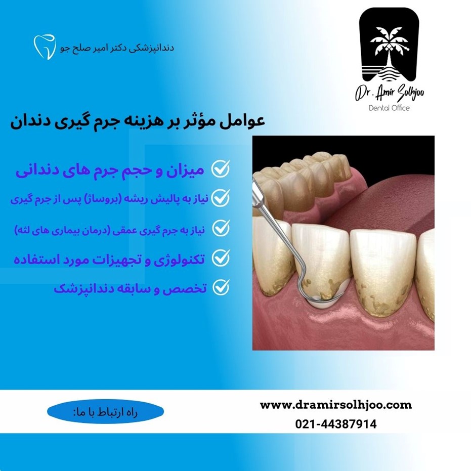 هزینه جرم گیری در غرب تهران