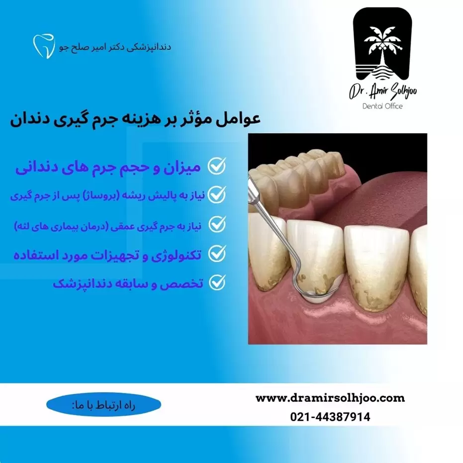 هزینه جرم گیری در غرب تهران
