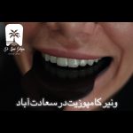 ونیر کامپوزیت در سعادت آباد
