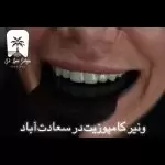 ونیر کامپوزیت در سعادت آباد