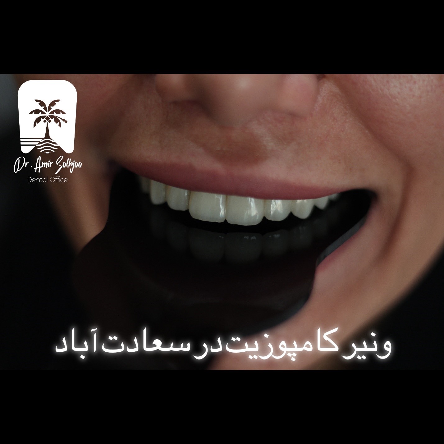 ونیر کامپوزیت در سعادت آباد