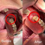 بهترین دندانپزشکی و دندانپزشک در گیشا