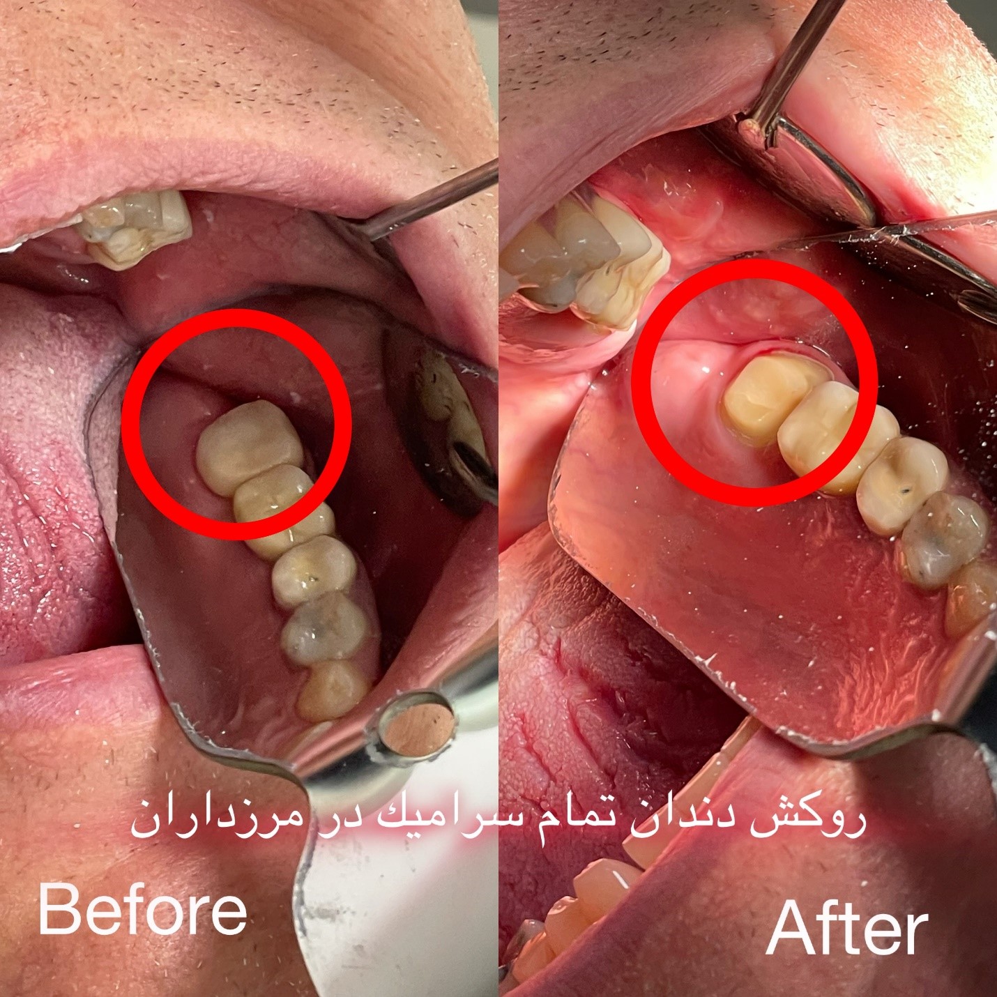 بهترین دندانپزشکی و دندانپزشک در گیشا