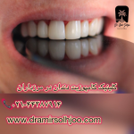 کلینیک کامپوزیت دندان مرزداران