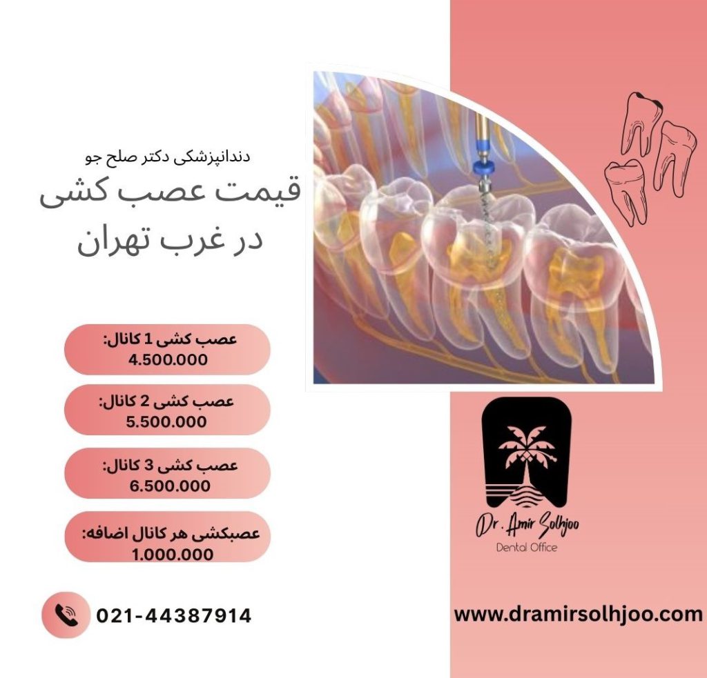 قیمت عصب کشی در غرب تهران