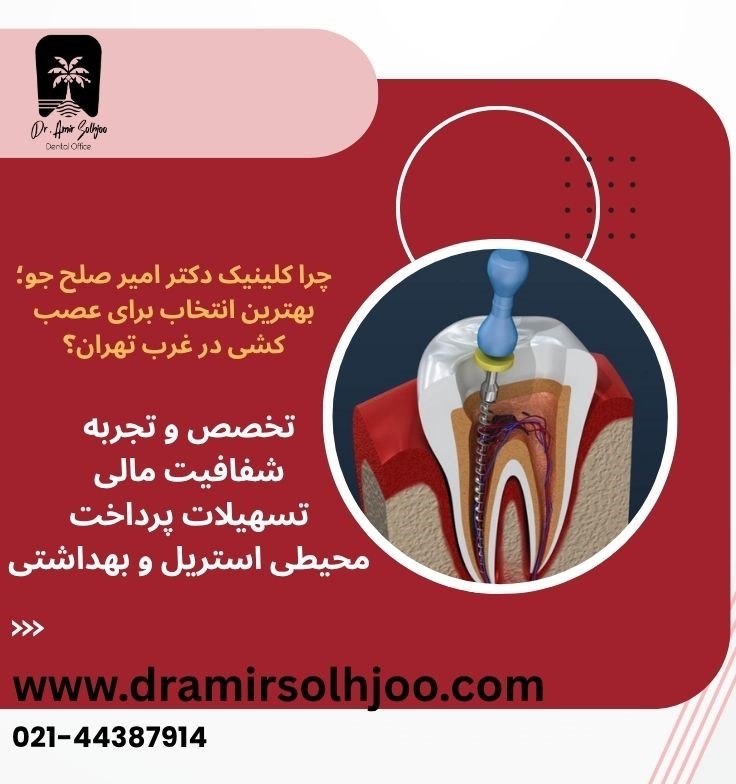 قیمت عصب کشی در غرب تهران