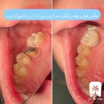 کلینیک دندانپزشکی در شهرک غرب