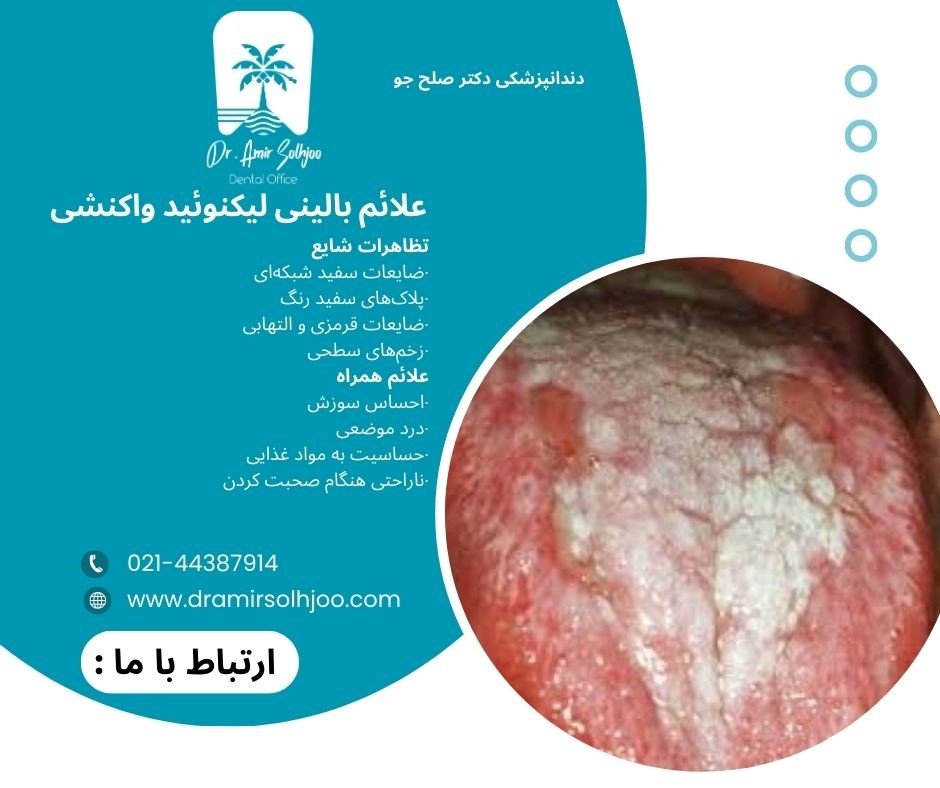 لیکنوئید واکنشی