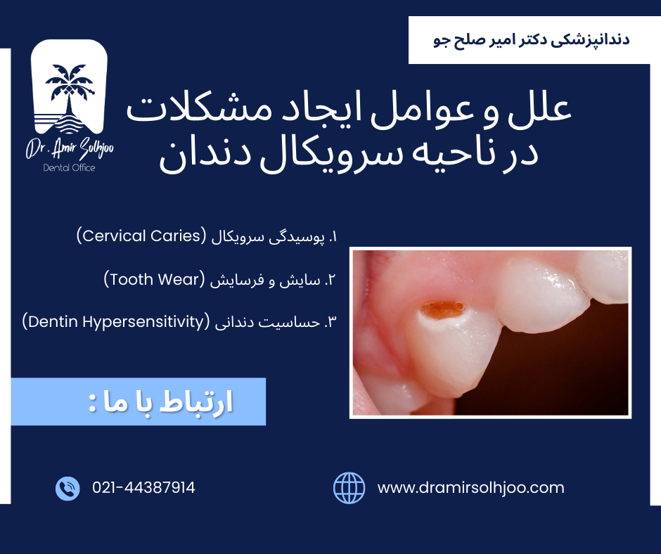 سرویکال دندان