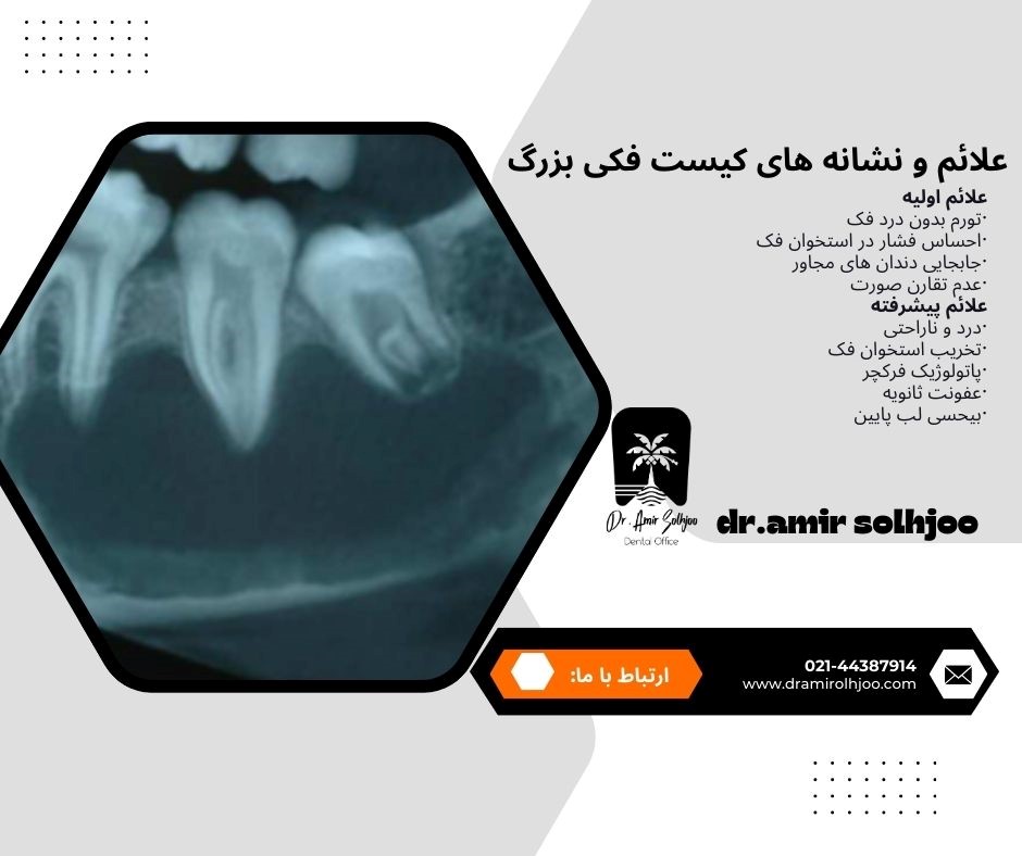 کیست فکی