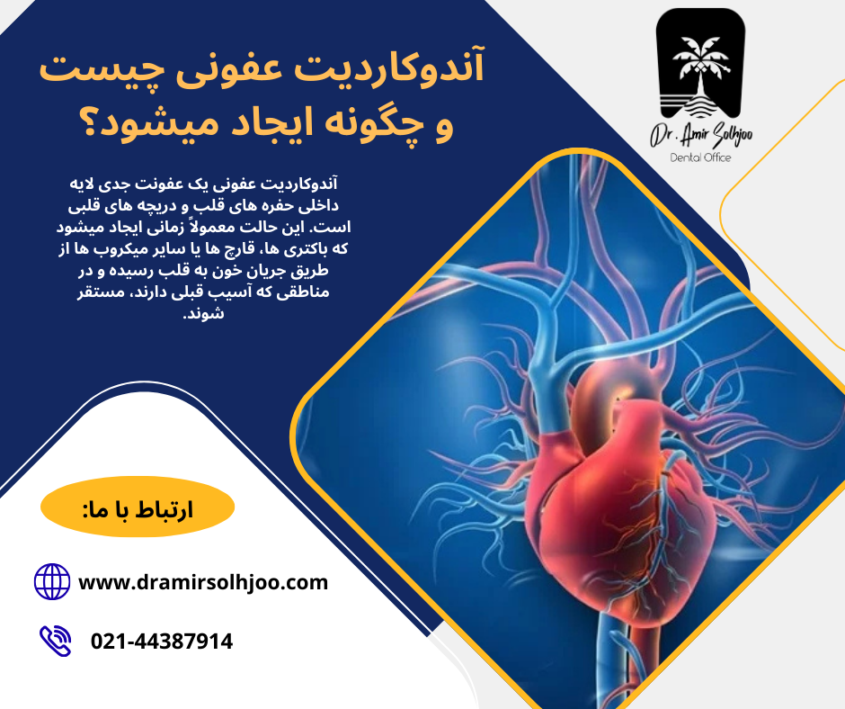 آندوکاردیت عفونی