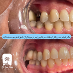 بهترین متخصص ایمپلنت دندان در غرب تهران