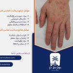 درماتیت تماسی