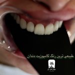 طبیعی ترین رنگ کامپوزیت دندان