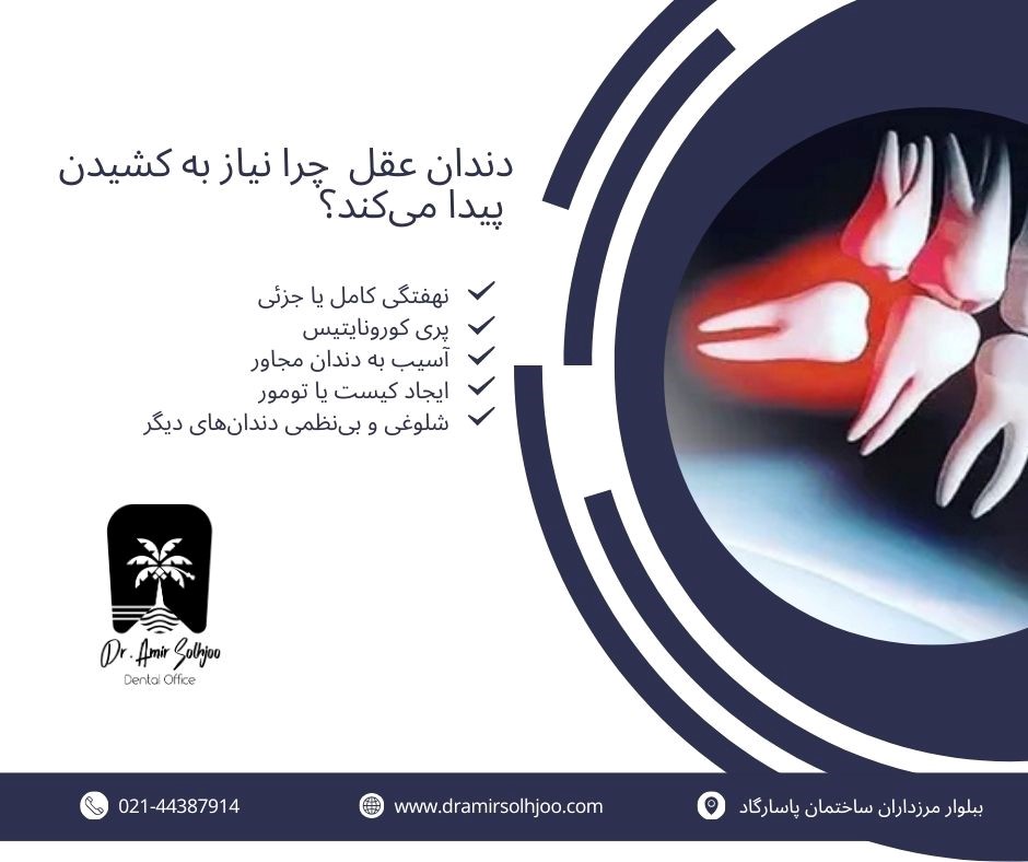 کشیدن دندان عقل در باغ فیض