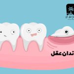 کشیدن دندان عقل در شهرک آزمایش و پاس فرهنگیان