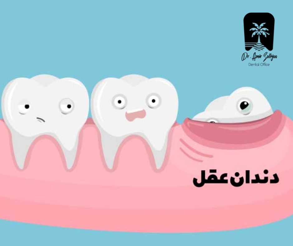 کشیدن دندان عقل در شهرک آزمایش و پاس فرهنگیان