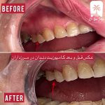 دندانپزشک زیبایی در گیشا