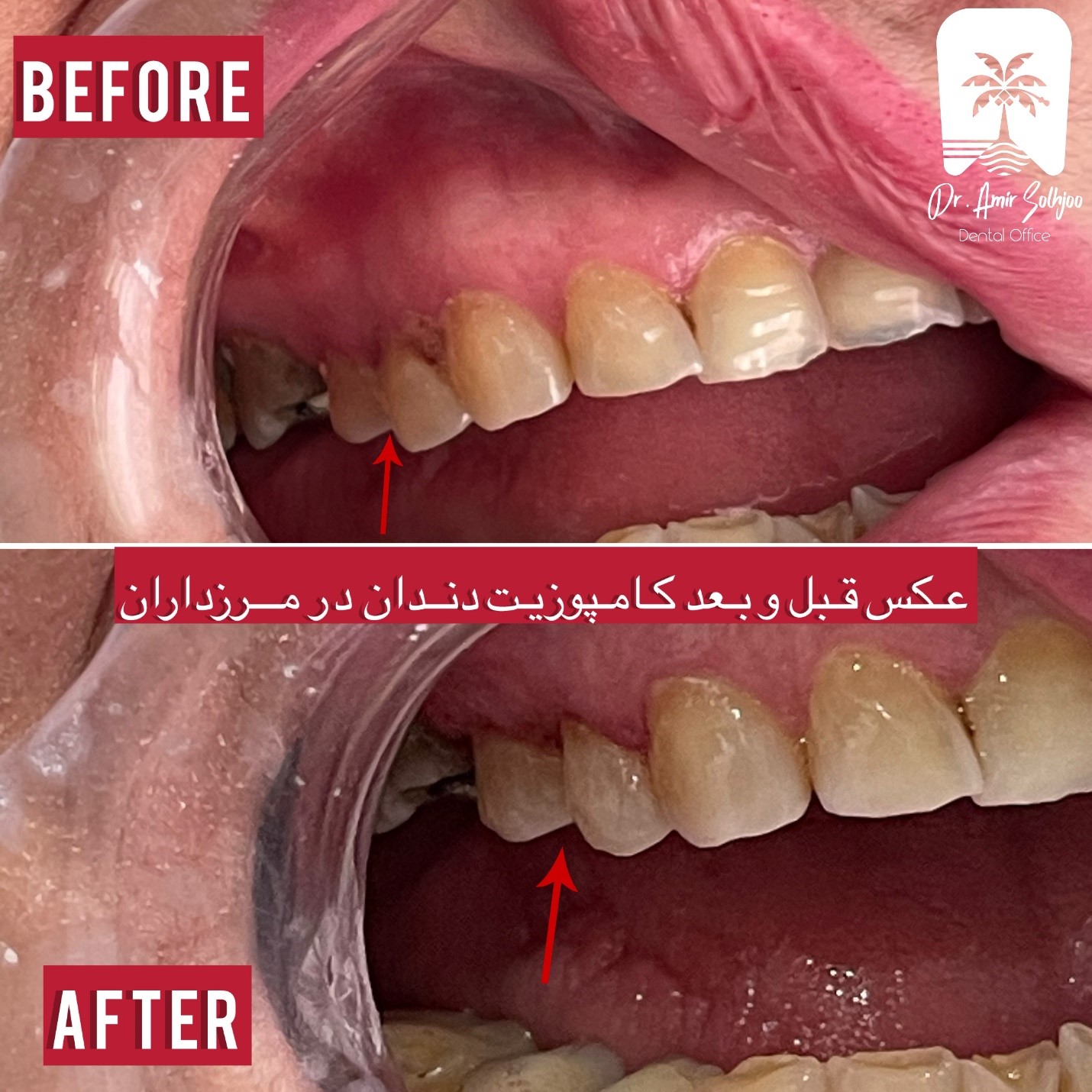 دندانپزشک زیبایی در گیشا