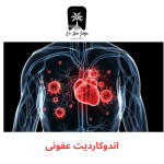 آندوکاردیت عفونی