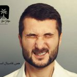 همی فاسیال اسپاسم
