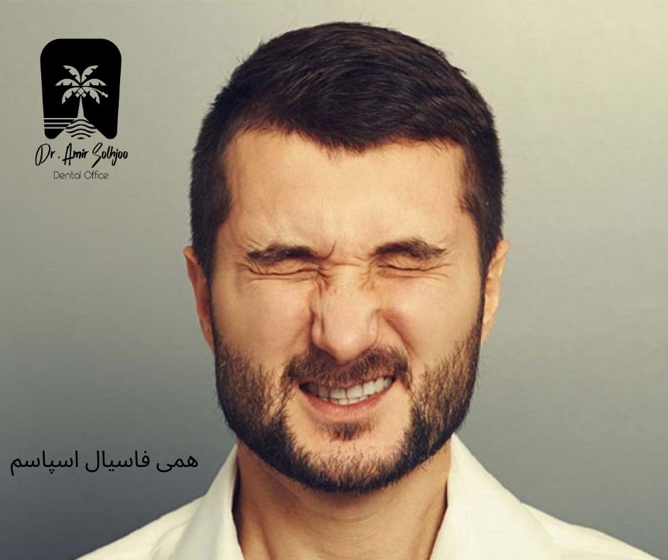 همی فاسیال اسپاسم