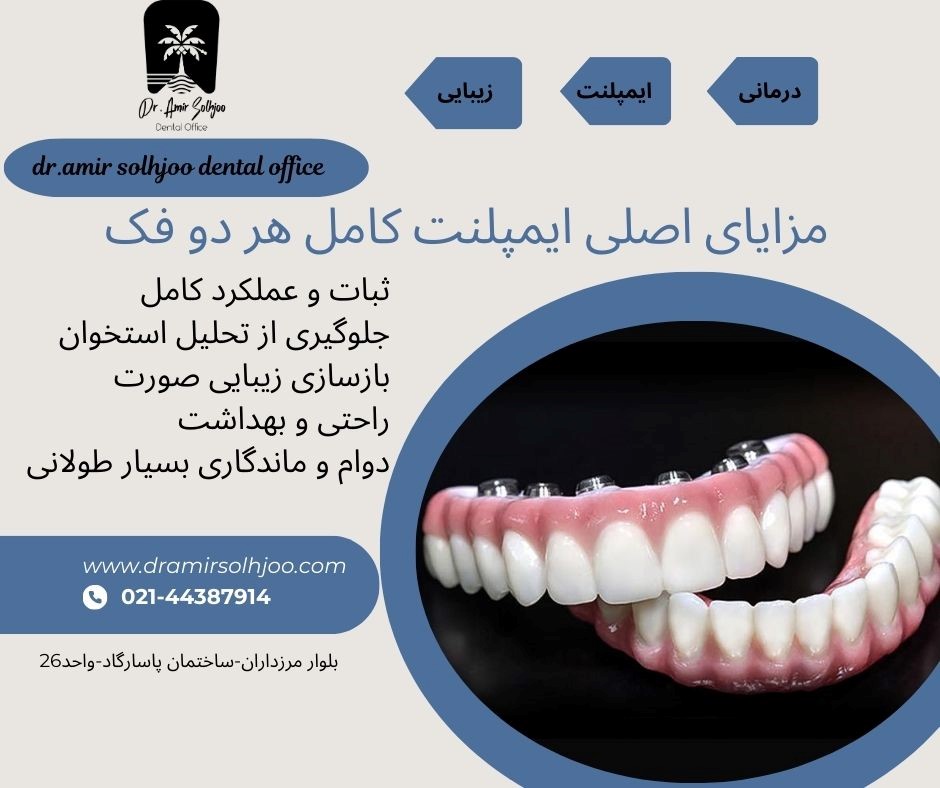 ایمپلنت کامل هر دو فک