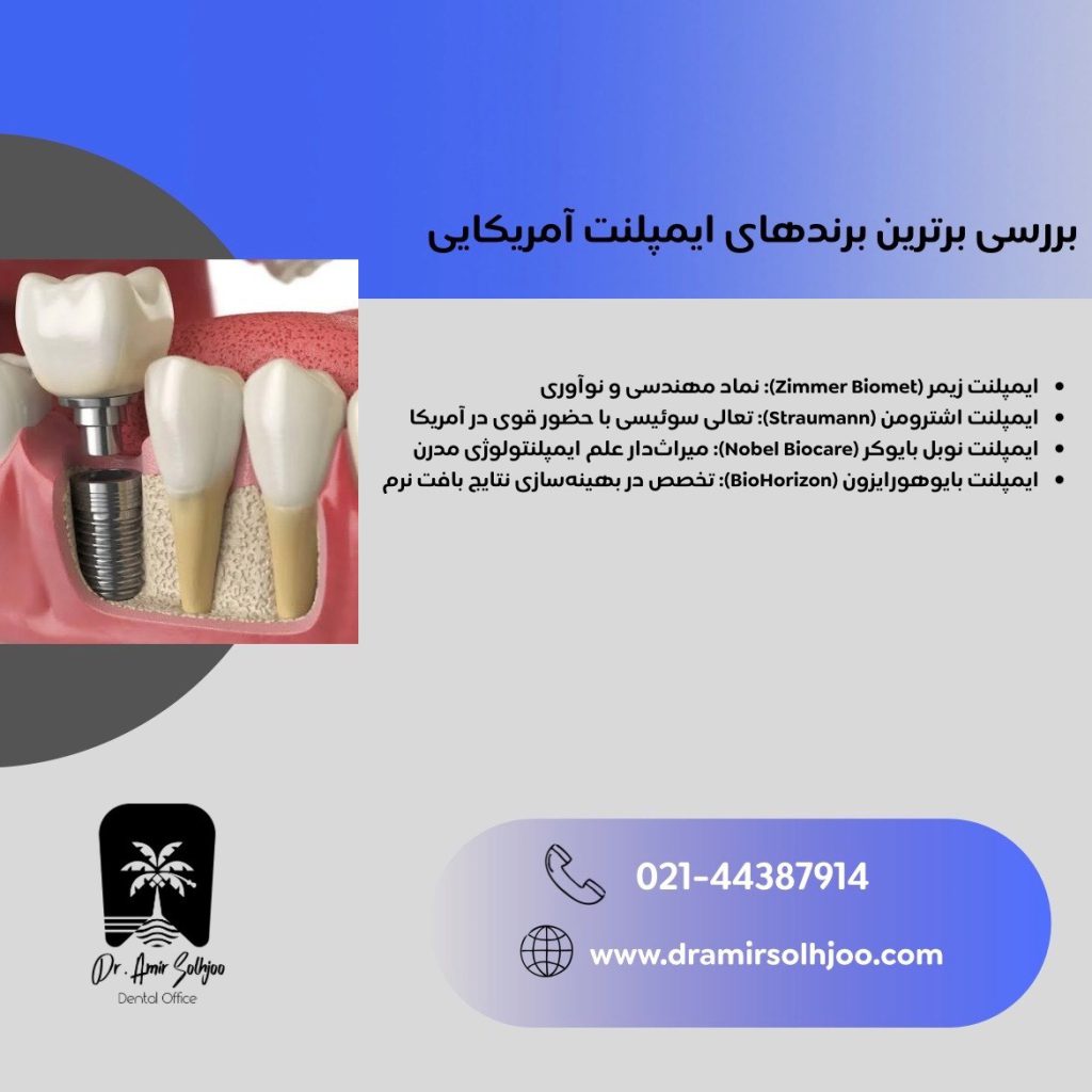 انواع ایمپلنت آمریکایی
