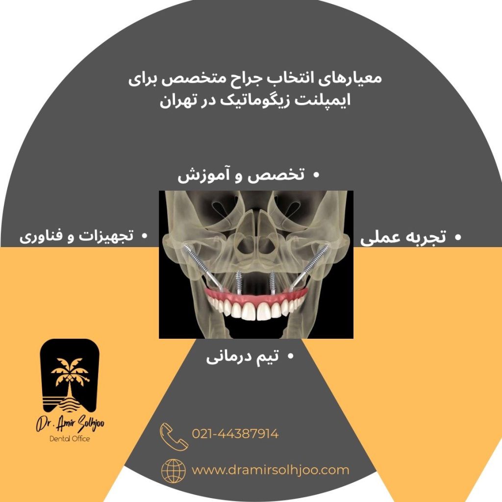 ایمپلنت زیگوماتیک در تهران