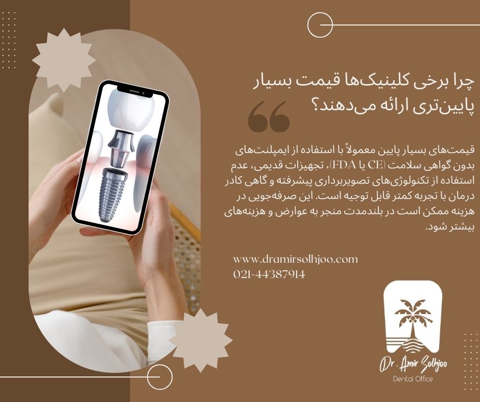 قیمت ایمپلنت در کلینیک مدرن