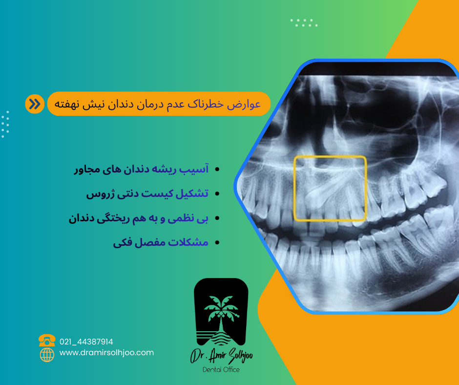 جراحی دندان نیش نهفته در گیشا