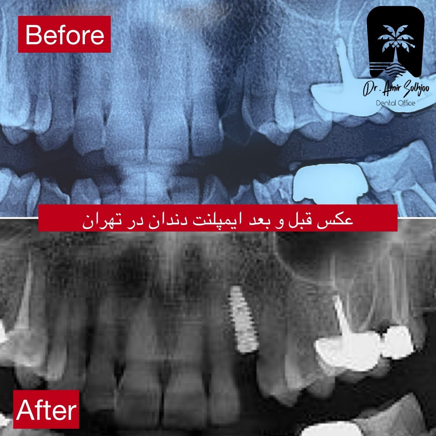 بهترین ایمپلنتولوژیست تهران