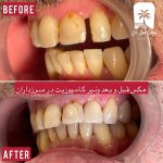 دندانپزشک زیبایی در سعادت آباد