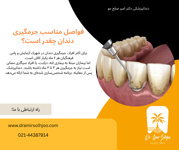 جرمگیری دندان در شهرک آزمایش و پاس فرهنگیان
