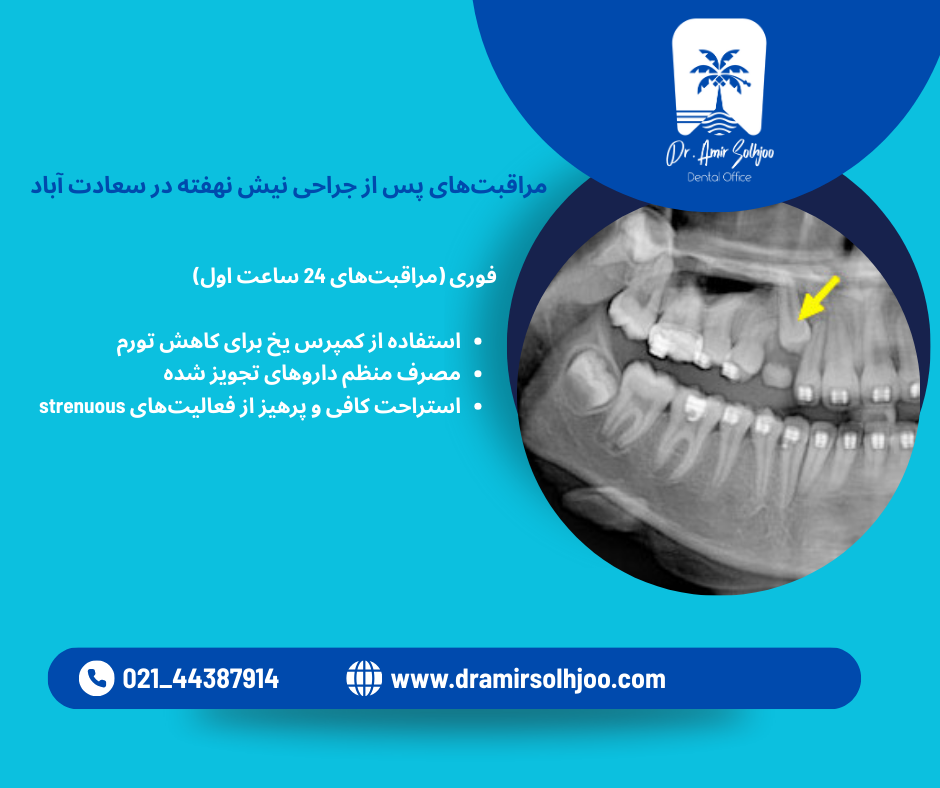 جراحی نیش نهفته در سعادت آباد
