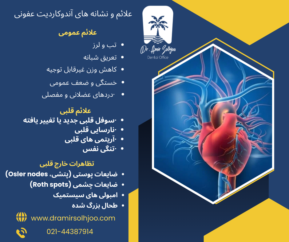 آندوکاردیت عفونی