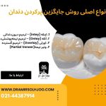 روش جایگزین پرکردن دندان