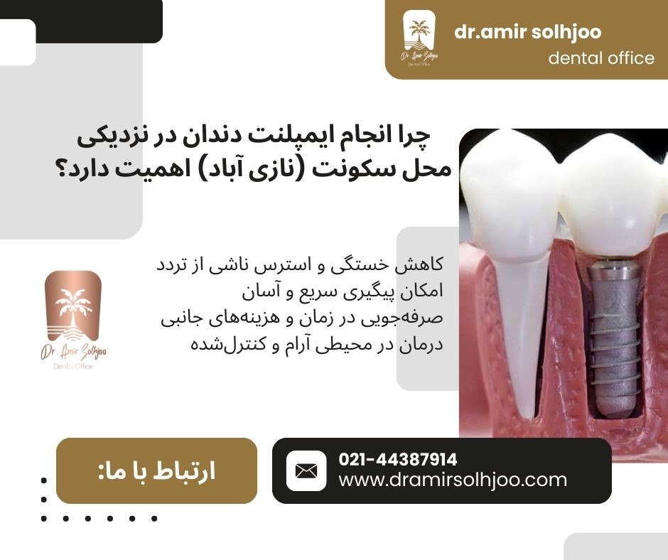 Dental implant in Naziabad