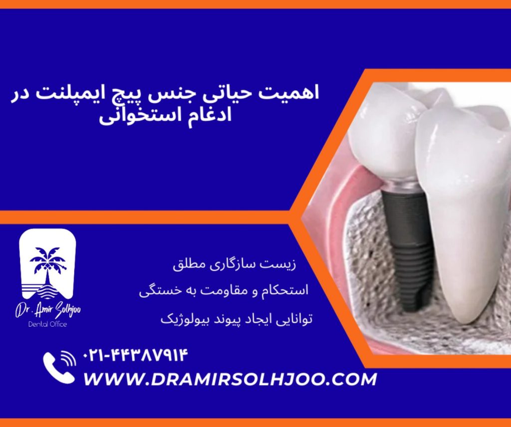 جنس پیچ ایمپلنت