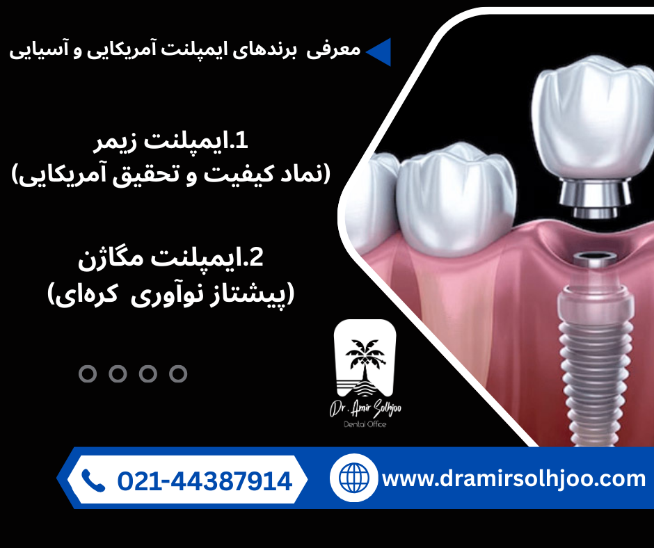 معرفی برندهای ایمپلنت