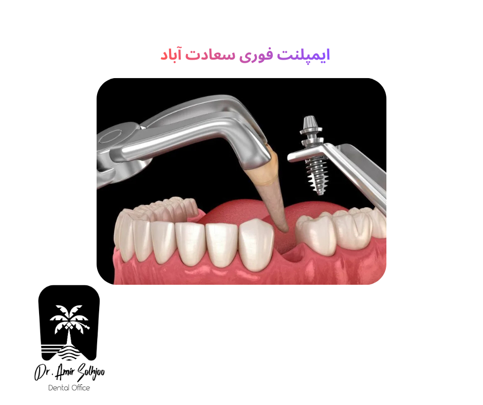 implant Fori Saadat Abad