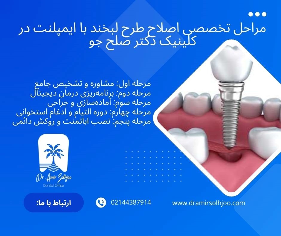 Dental implants in people with grinding teeth